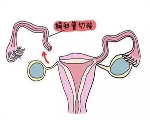 苏州代怀妈价格表,雌激素低会对做试管有影响吗？-上海做供卵试管婴儿多少钱